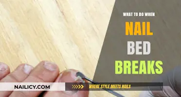 Healing a Broken Nail Bed: Quick Tips for Pain Relief and Recovery