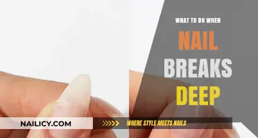 Quick Fixes for Deeply Broken Nails: Repair and Recovery Tips
