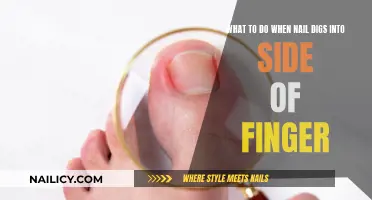 How to Treat an Ingrown Nail at Home