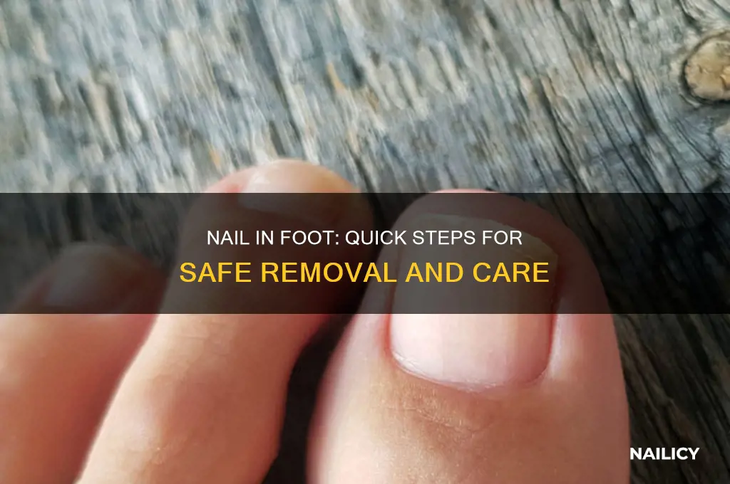 what to do when nail goes in foot