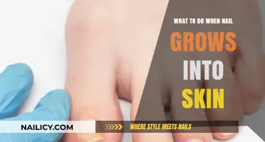 Treating Ingrown Nails: Home Remedies and Professional Care