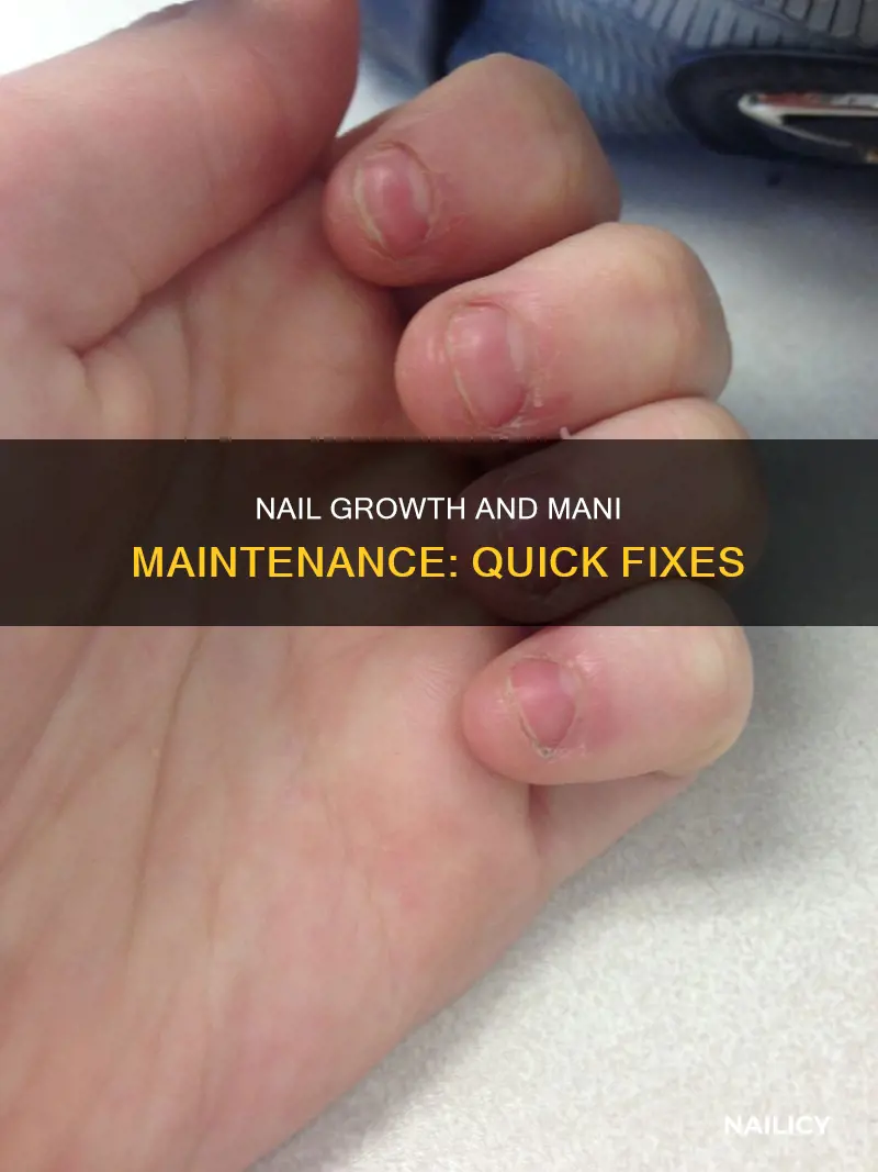what to do when nail grows out and mani dissapears