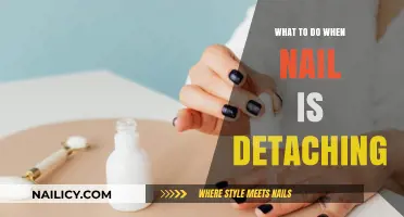 Nail Detaching? Quick Fixes and Care Tips for Healthy Recovery