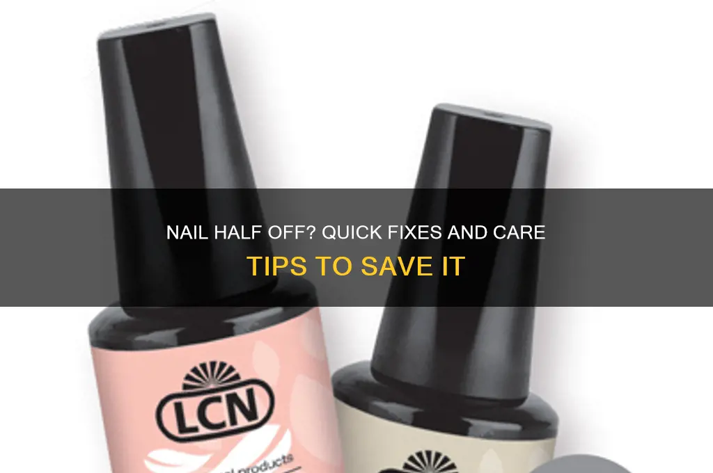 what to do when nail is half off