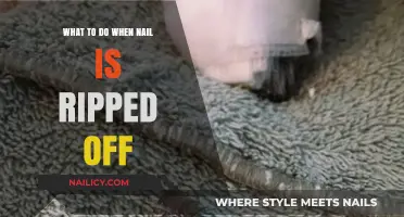 Nail Ripped Off? Immediate Steps for Pain Relief and Healing