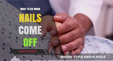 Nail Emergency: Quick Fixes and Care Tips for Lost Nails