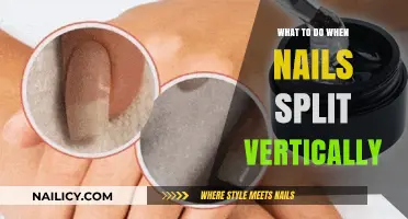 How to Repair and Prevent Vertically Split Nails: Expert Tips