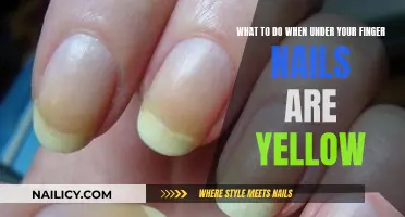 Yellow Nail Mystery: Uncover Hidden Health Clues