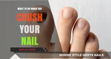 Ouch! Quick Fixes for Crushed Nails: Relief and Recovery Tips
