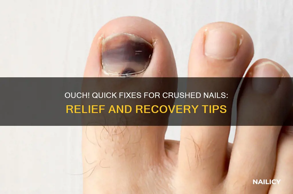 what to do when you crush your nail