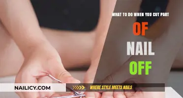 First Aid for Nail Emergencies: What to Do?