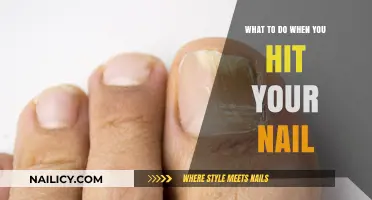 Ouch! Quick Fixes and Remedies for a Painful Nail Injury