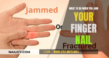 Immediate Care for Jammed Fingernail: What You Need to Know