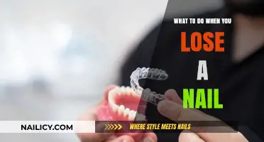 Quick Fixes and Care Tips for a Lost Nail Emergency