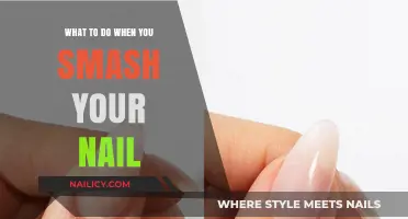 Quick Fixes for a Broken Nail: Repair and Recovery Tips