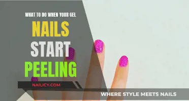 Gel Nails Peeling: Quick-Fix Guide for Long-Lasting Manicures