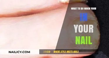 Ouch! Quick Fixes for When Your Nail Gets Injured