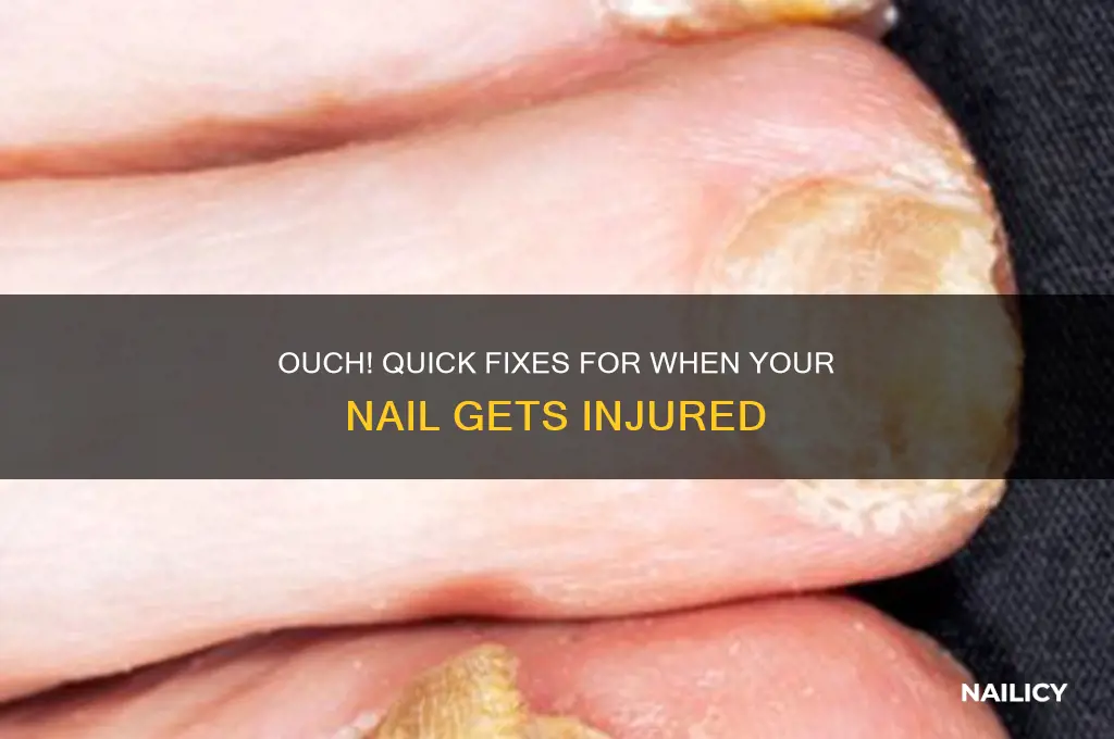 what to do when your in your nail