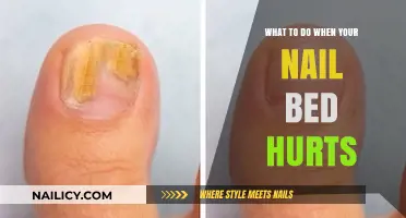 Soothe Sore Nail Beds: Quick Remedies for Pain Relief