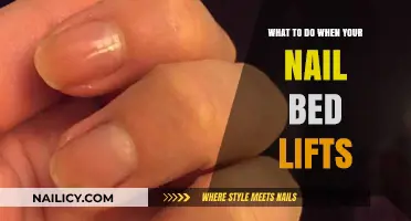 Nail Bed Lifting? Quick Fixes and Prevention Tips for Healthy Nails