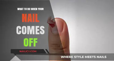 Nail Emergency: Quick Steps to Handle a Detached Nail Safely