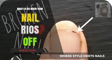 Ripped Nail Rescue: Quick Fixes and Care Tips for Broken Nails