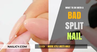 Quick Fixes for a Bad Split Nail: Repair and Prevent