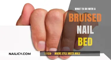 Healing a Bruised Nail Bed: Quick Tips for Pain Relief and Recovery