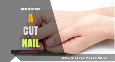 Treating Cut Nails: Quick Home Remedies and Tips