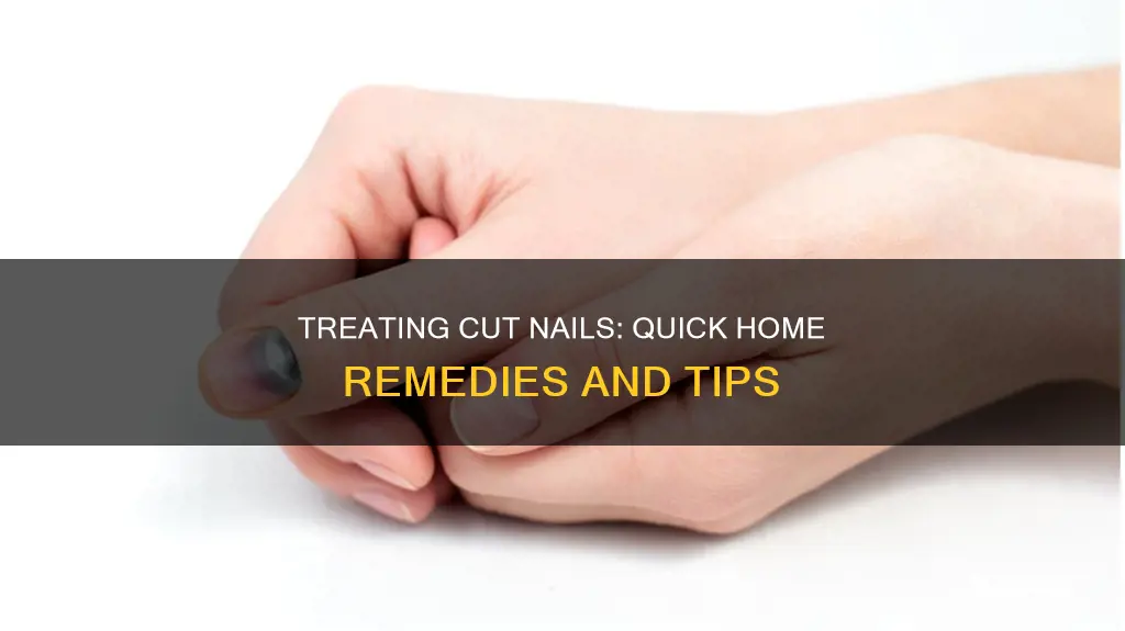 what to do with a cut nail