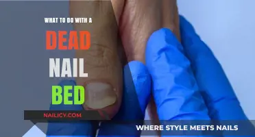 Reviving Dead Nail Beds: Effective Treatments and Care Tips