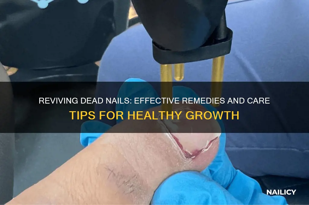 what to do with a dead nail