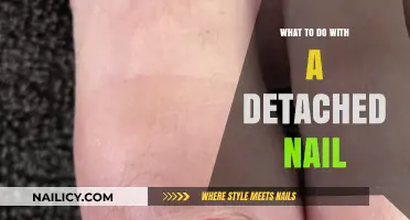 Detached Nail? Quick Fixes and Care Tips for Healing
