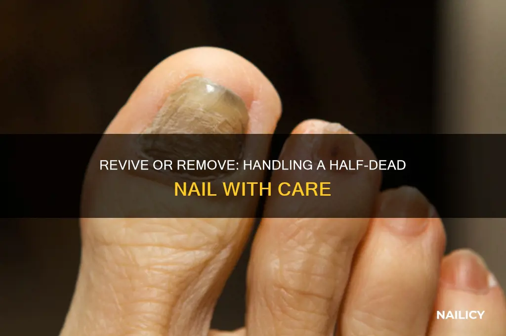what to do with a half dead nail