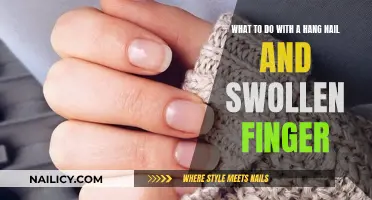 Hangnail Havoc: Swollen Finger Solutions