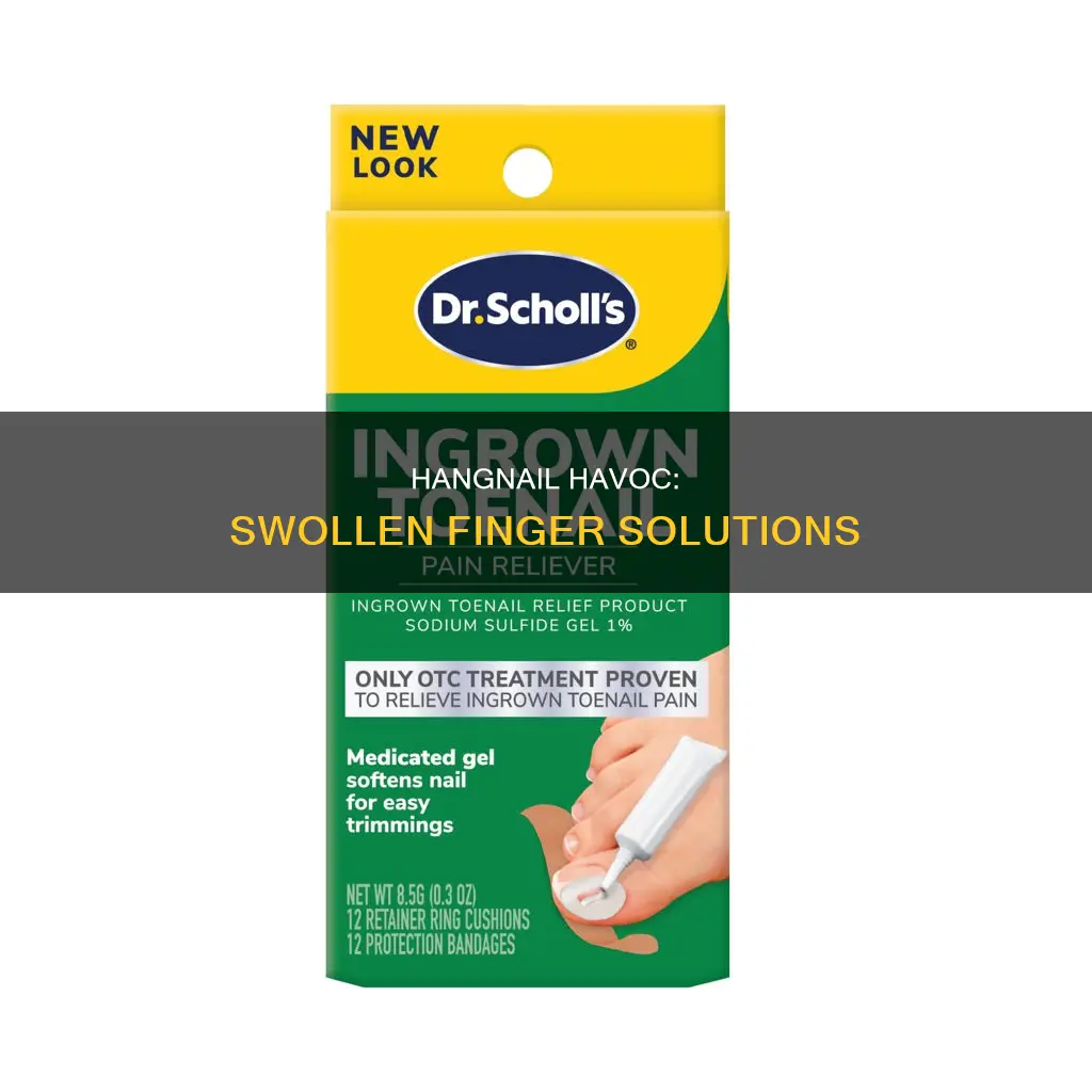 what to do with a hang nail and swollen finger