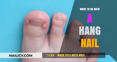 Quick Fixes for Hangnails: Prevent Pain and Promote Healing Fast