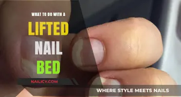 Healing a Lifted Nail Bed: Effective Remedies and Care Tips