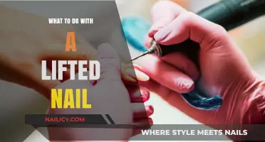 Lifted Nail? Quick Fixes and Care Tips for Healthy Recovery