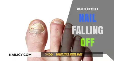 Nail Falling Off? Here’s How to Handle It Safely and Effectively