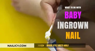 How to Safely Treat and Prevent Baby Ingrown Toenails