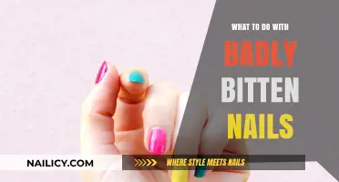 Heal and Restore: Solutions for Badly Bitten Nails