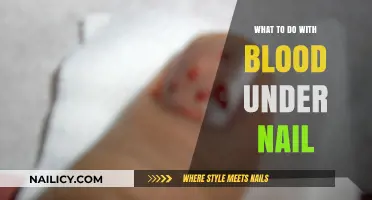 Quick Relief: Treating and Preventing Blood Under Your Nail