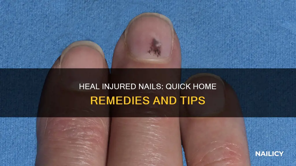 what to do with cut injured nails