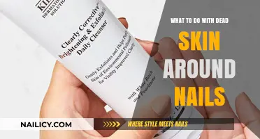 Revive Your Nail Health: Tackle Dead Skin Around Nails Effectively