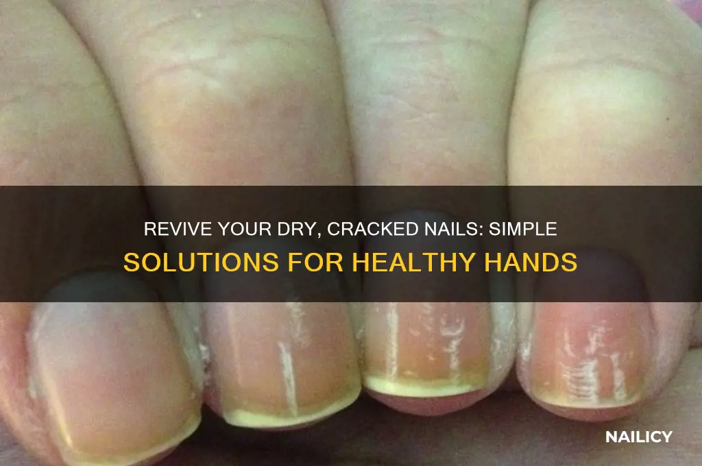 what to do with dry cracked nails