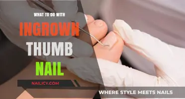 Effective Remedies and Prevention Tips for Painful Ingrown Thumb Nails