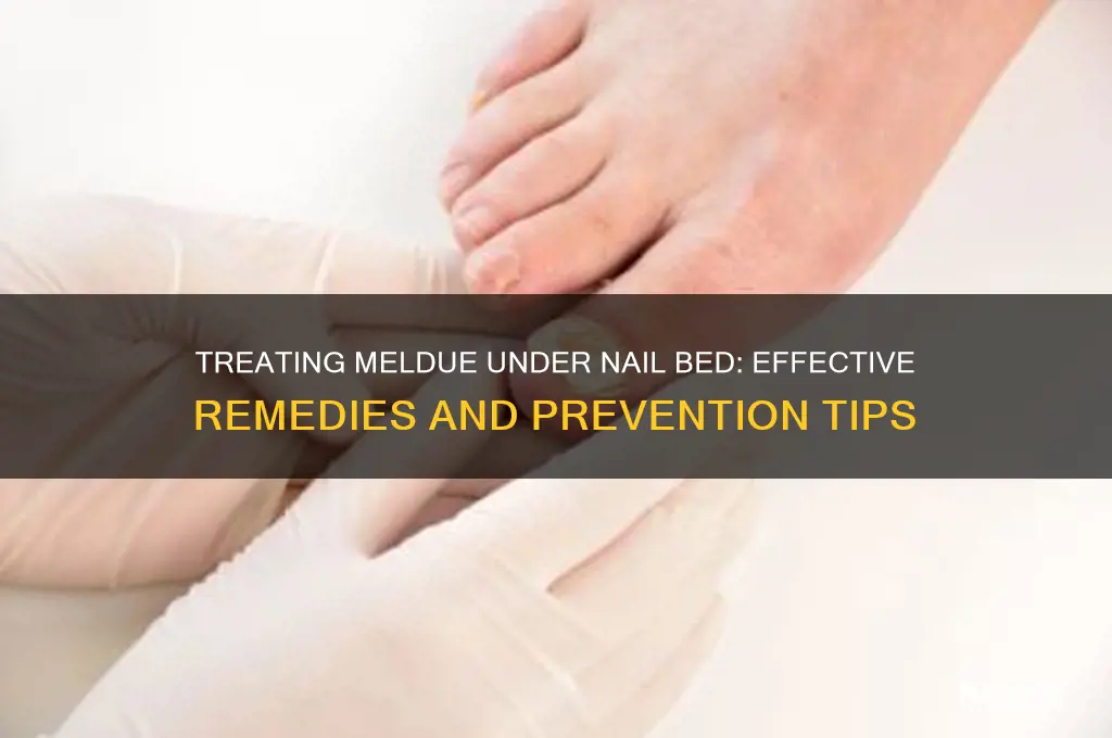 what to do with meldue under nail bed