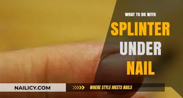 Splinter Under Nail? Quick Relief Tips and Safe Removal Guide