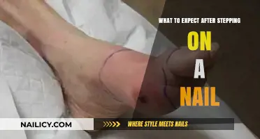 Stepped on a Nail? Here's What to Expect and Do Next